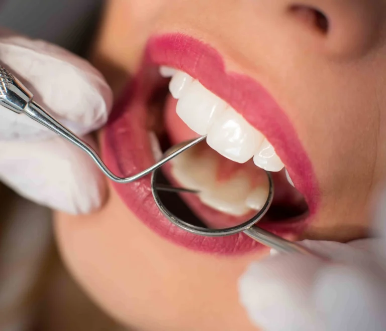Dental Treatments